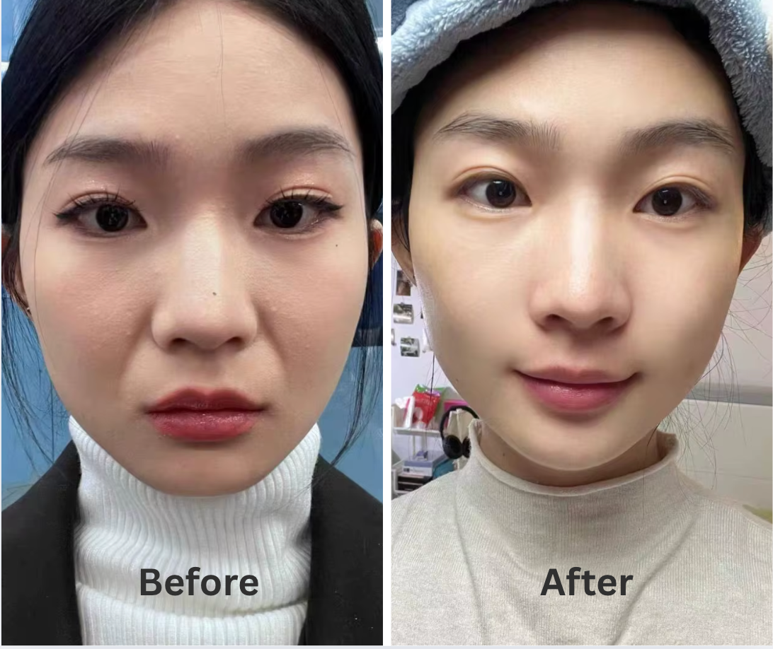 Collagen Night Wrapping Mask by Cove™